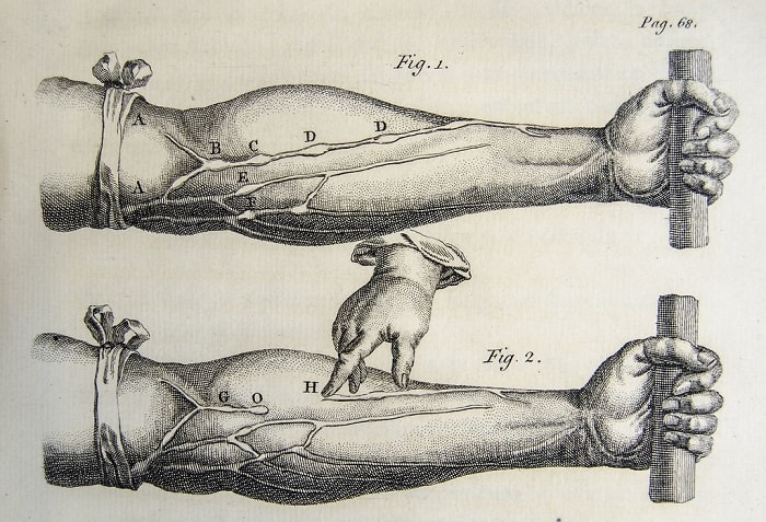 A drawing from William Harvey’s de Motu Cordis, 1628, depicting forearm surgery.