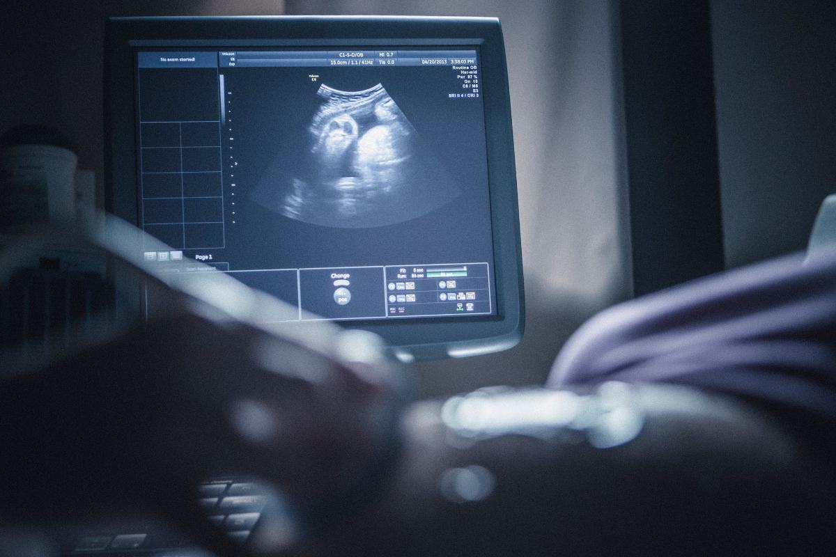 Does a child in the womb feel the ultrasound scan