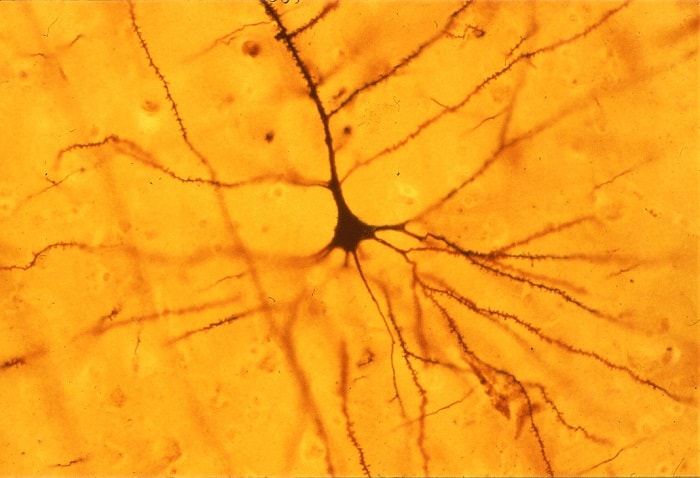 The appearance of the neuron via the Golgi staining technique shows the fine structure of dendrites and axons.