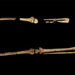 Oldest known surgery from 31,000 years ago