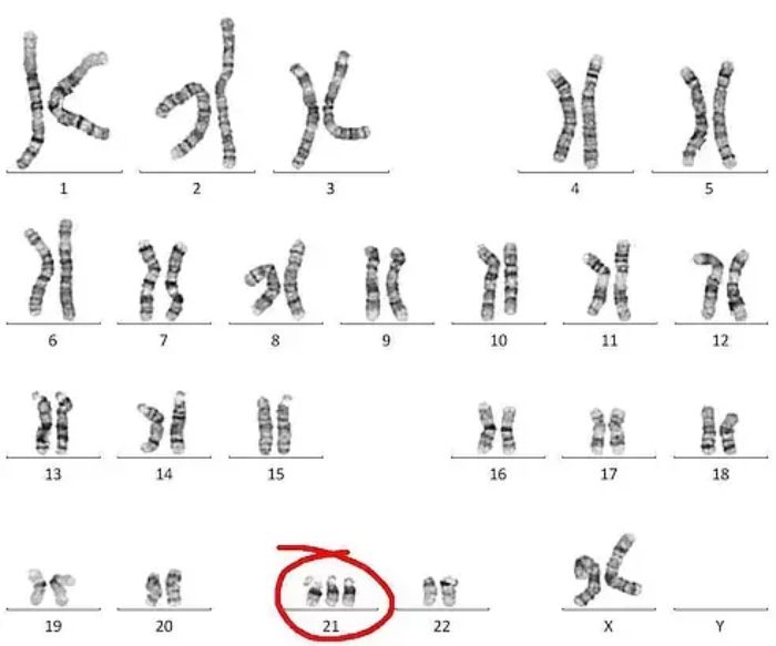 Chromosome extra