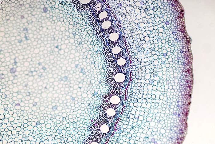 Xylem, which looks like a network of bundles that resemble a ladder, is how plants move water upwards. This part reveals their holes.