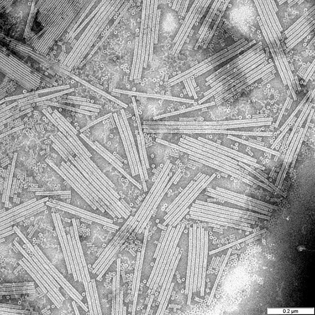 Tabaco mosaic virus crystals.