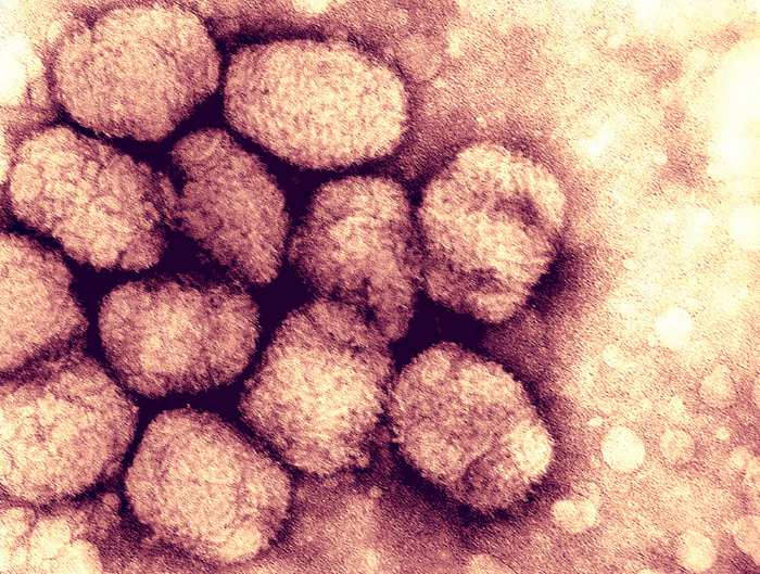 Variola major, or smallpox virus.