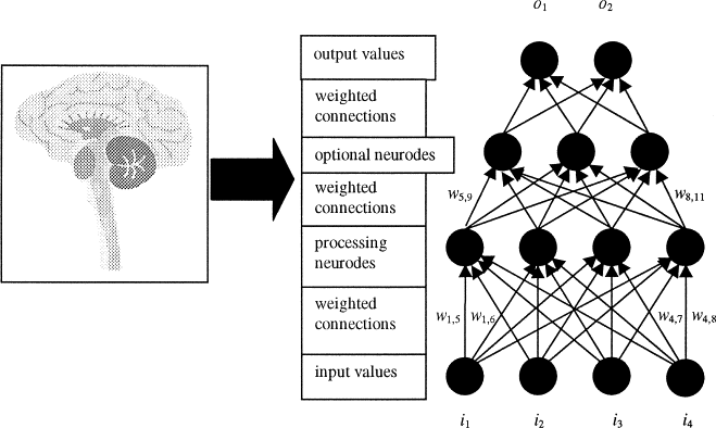 artificial neural network