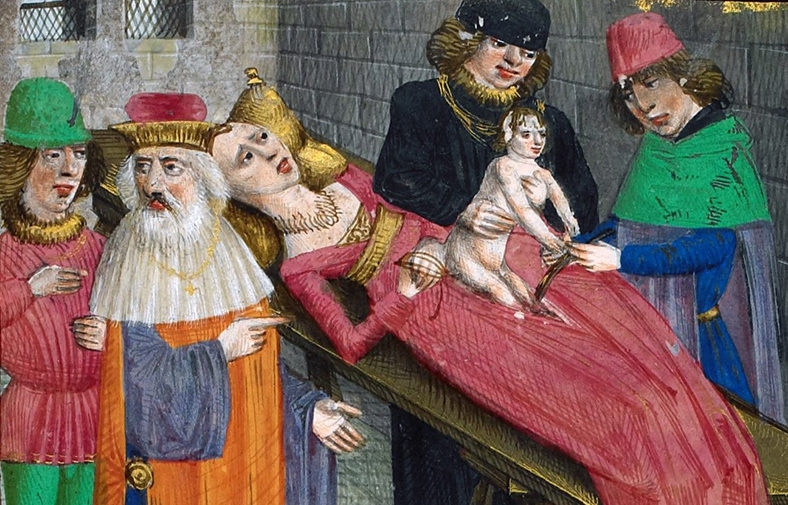 Medieval depiction of Caesarian birth. Source: British Library