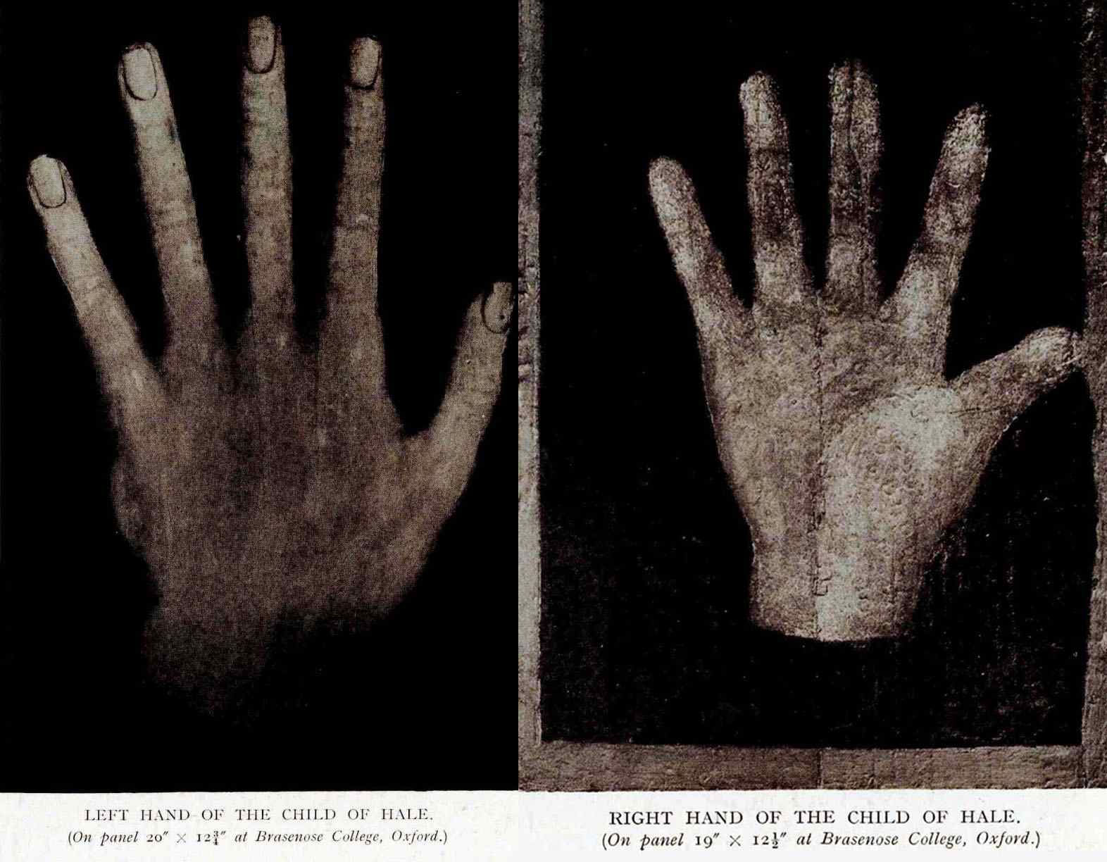 The left and right hands of John Middleton. From the book "The 'Child of Hale' (John Middleton); some portraits." by the British historian R. Stewart-Brown (1872--1940).