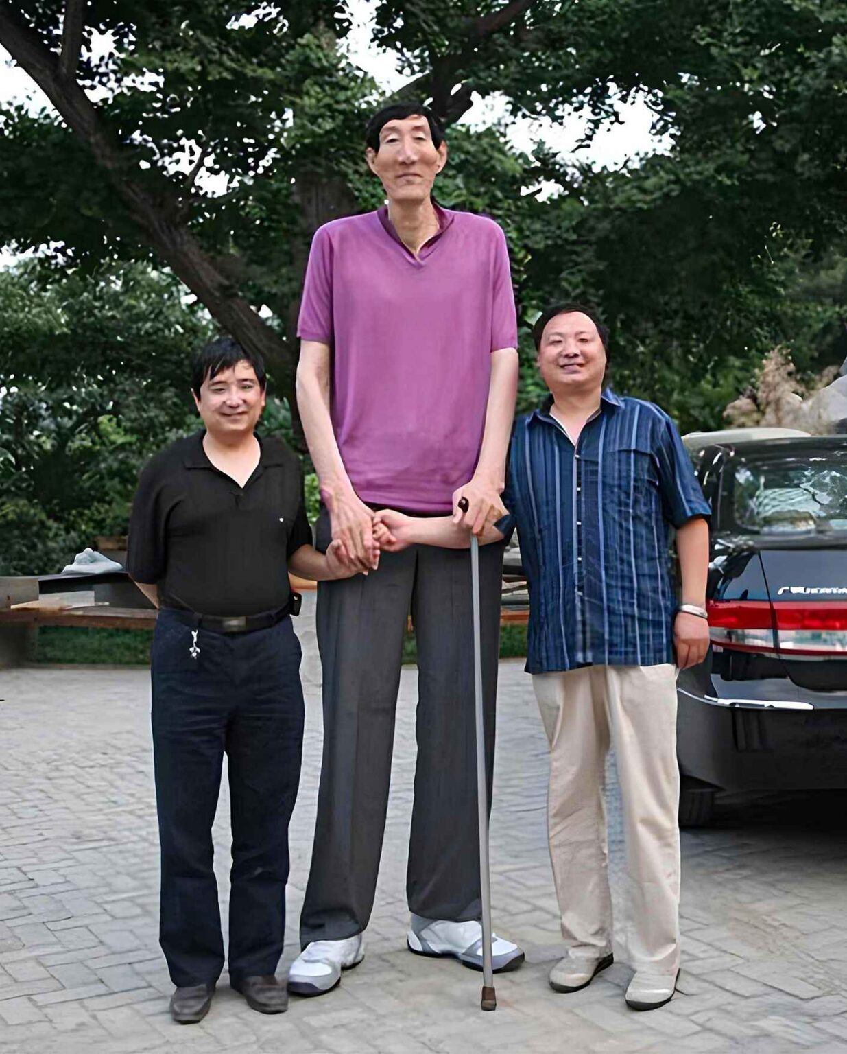 Bao Xishun: An Extremely Tall Man Without Gigantism - Malevus