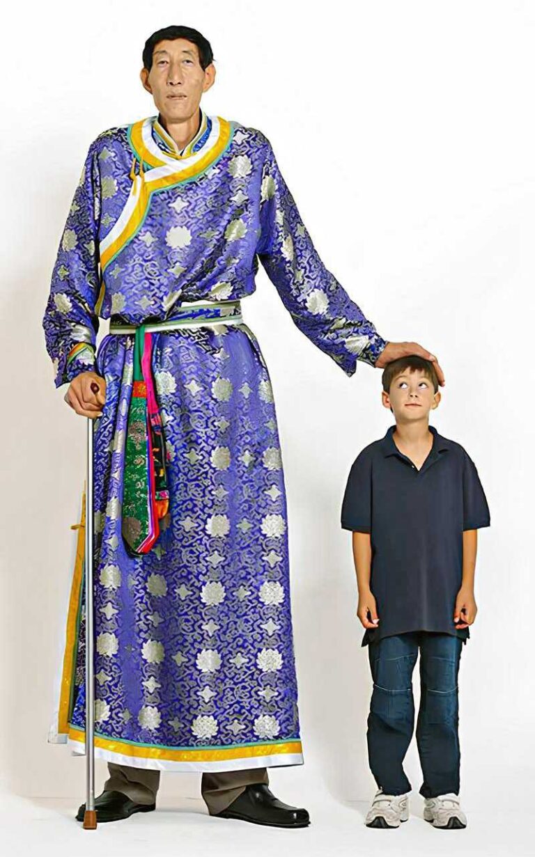 Bao Xishun: An Extremely Tall Man Without Gigantism - Malevus