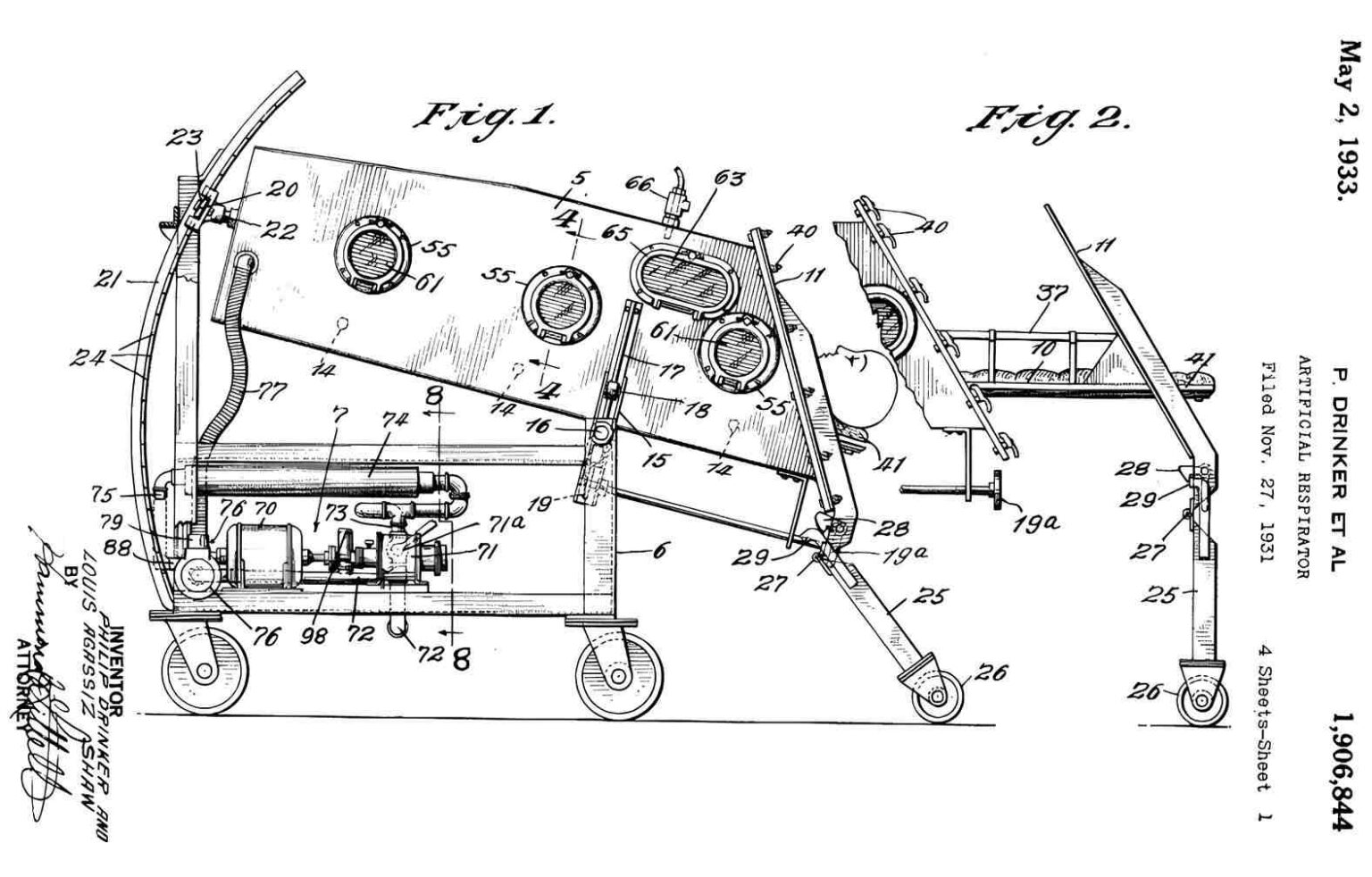 Iron Lung History, How It Works, and More Malevus