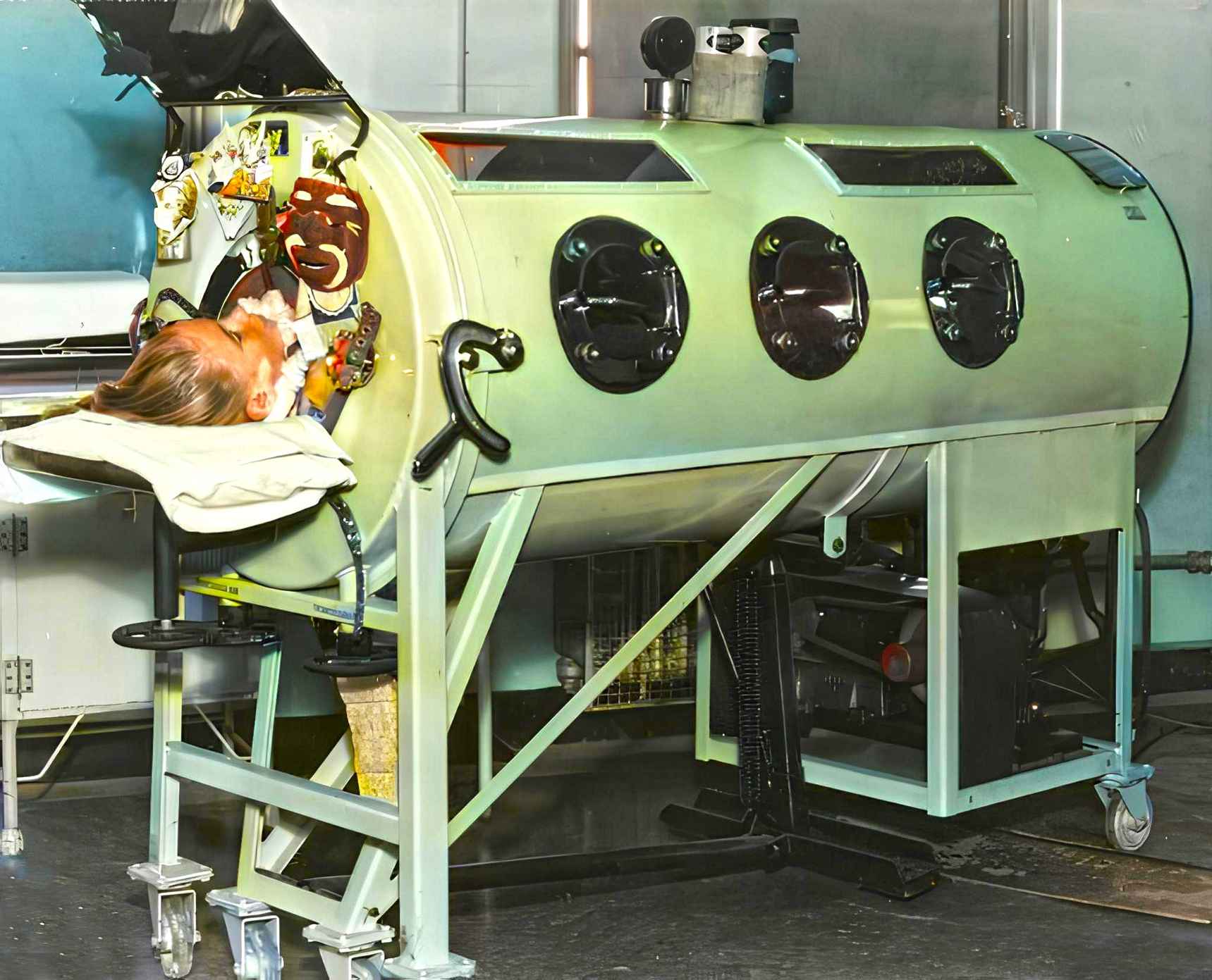 The Emerson Respirator was a more efficient alternative to the iron lung.