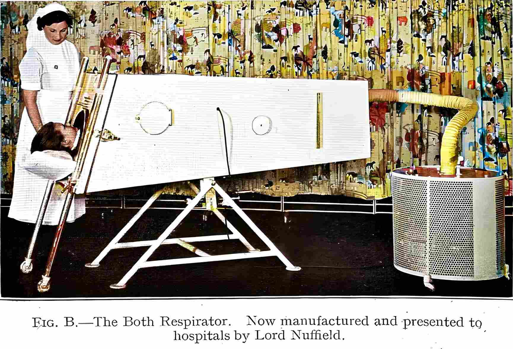 The Both Respirator was a cheaper alternative to the iron lung.