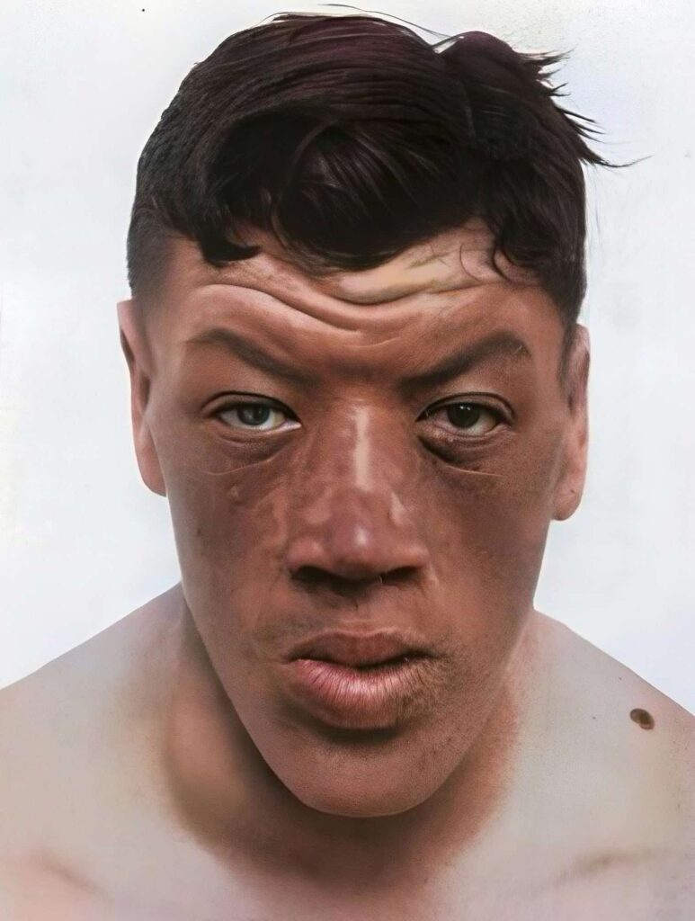 Adam Rainer: He Was 4'6