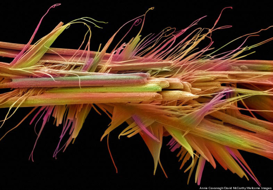 Caffeine crystals under an electron microscope.