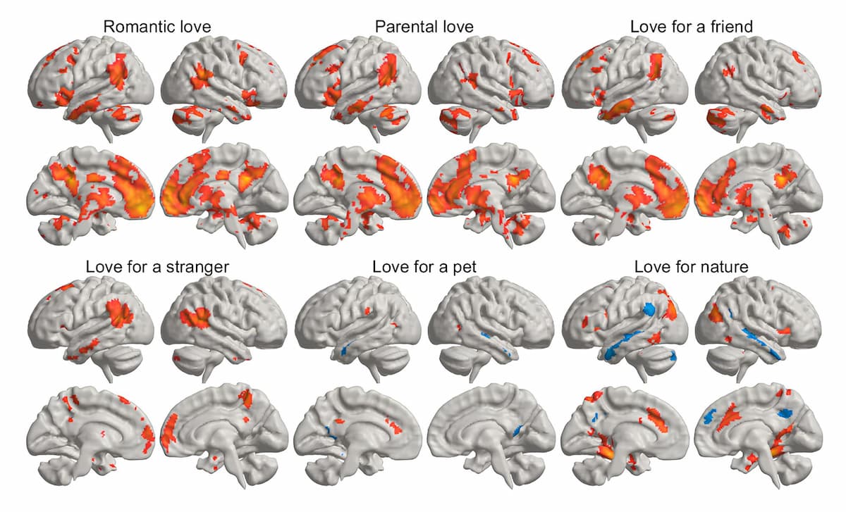 brain love