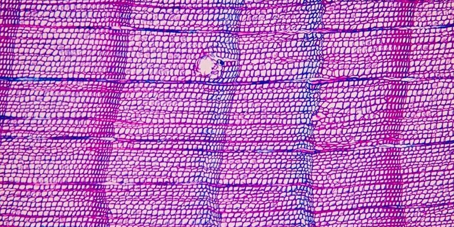 Cambridge Scientists Explain How Europe's Deadliest Plague Arrived — Because of Volcanoes 2 So-called blue tree rings in the Pyrenees